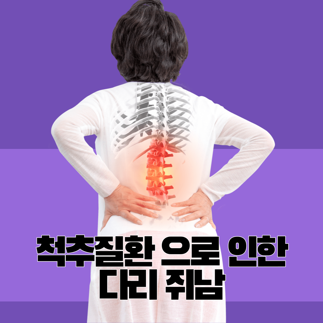 다리-혈액-순환